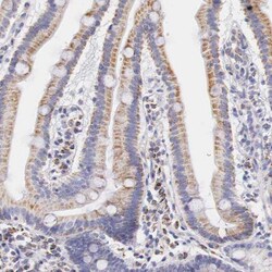 IDH3G Antibody, Novus Biologicals 0.1mL; Unlabeled:Antibodies, Polyclonal